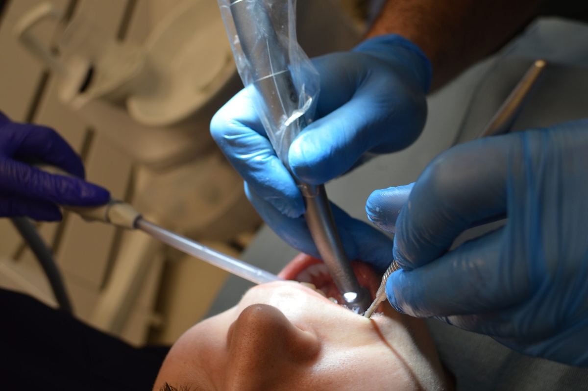 Traitement endodontique &agrave; la clinique